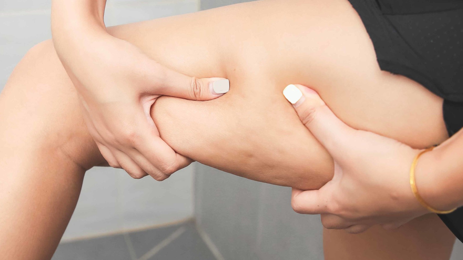 accettare la diagnosi di lipedema