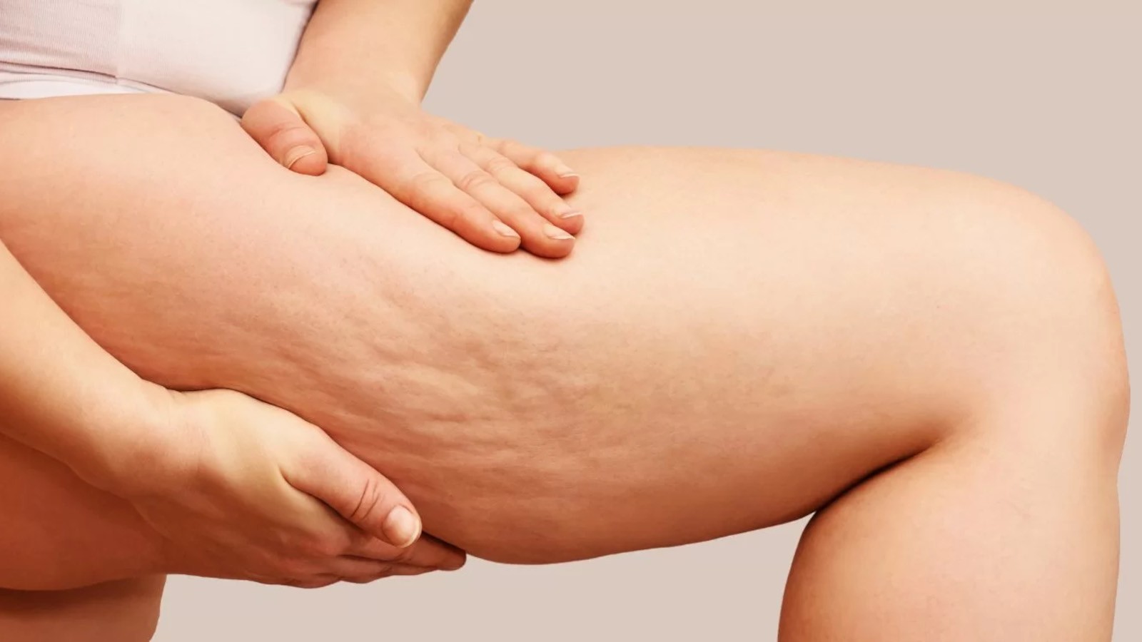 consigli pratici per gestire il lipedema