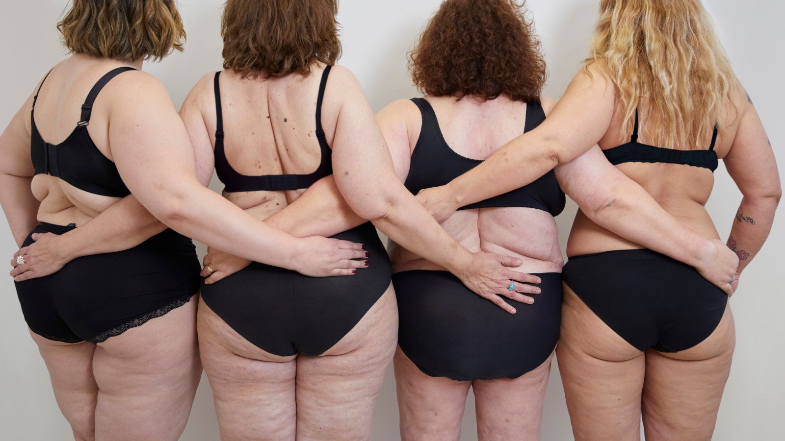 impatto psicologico del lipedema