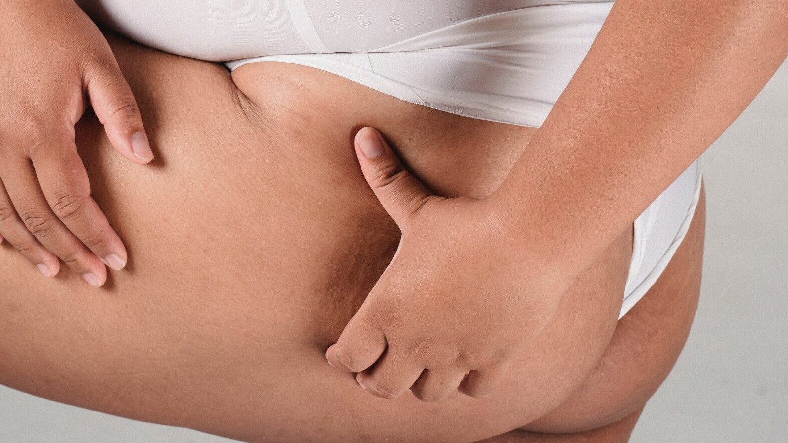 la mia vita con il lipedema una testimonianza