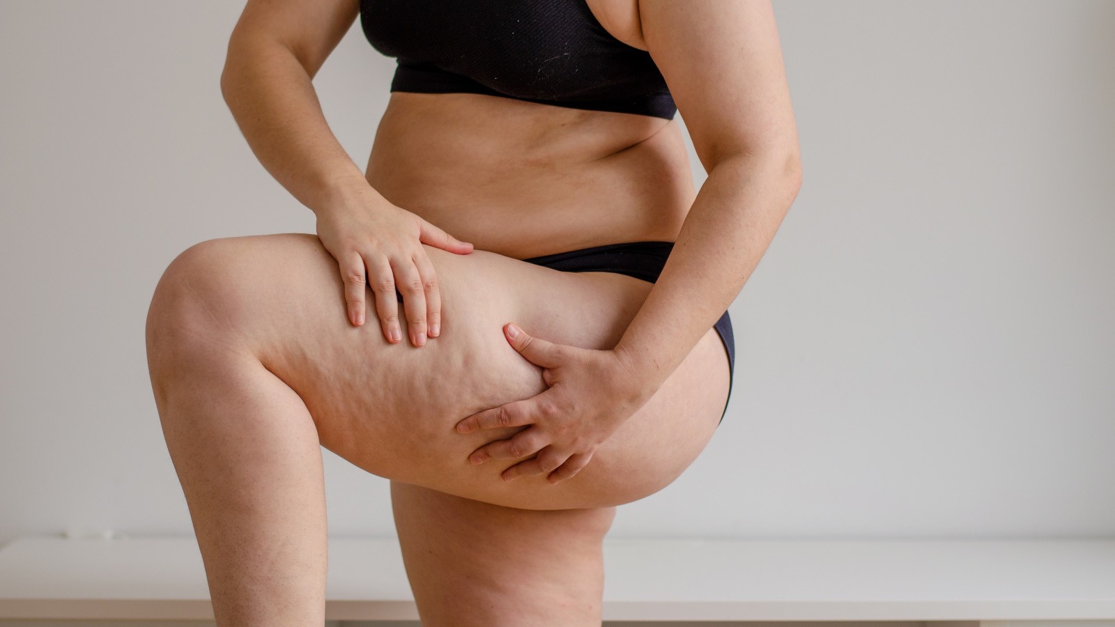lipedema ansia gestire lo stress legato alla patologia