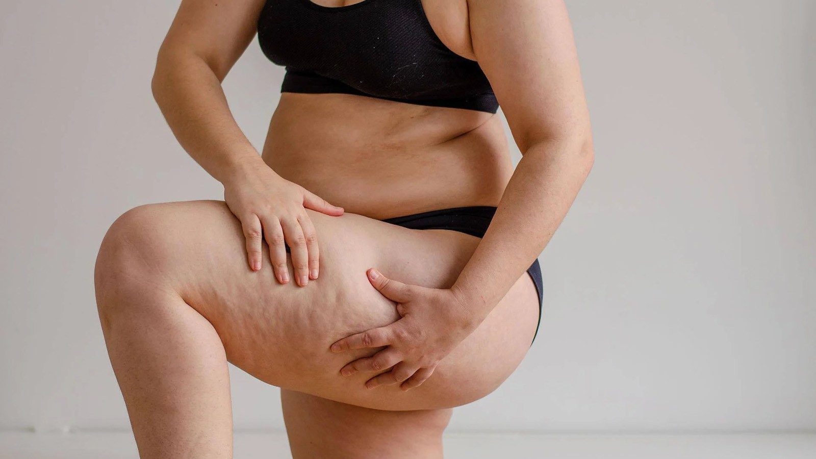 lipedema cause cosa scatena questa patologia del tessuto adiposo