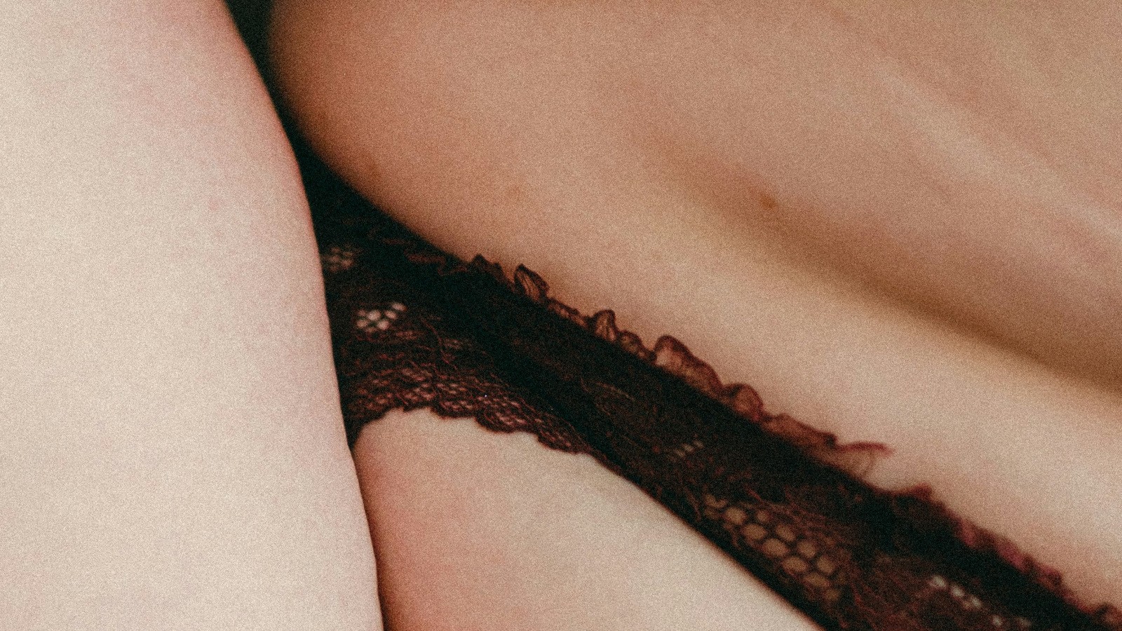 lipedema diagnosi test e esami per identificare la malattia