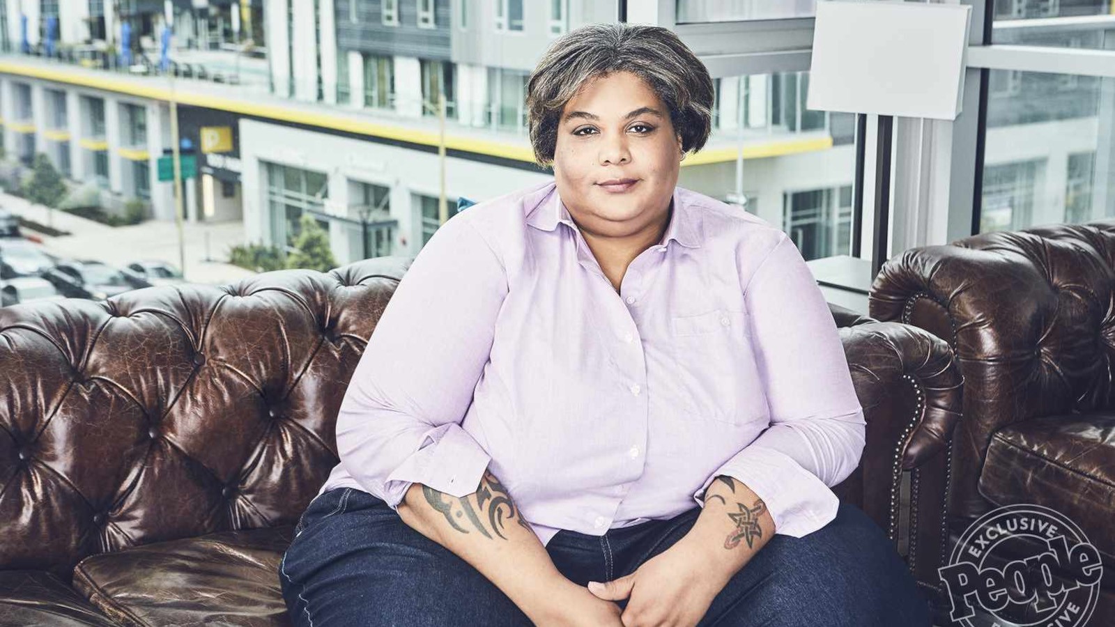 lipedema in spagna strutture specializzate